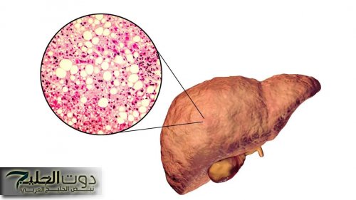«وداعًا لأدوية الكبد المكلفة!».. اكتشف العشبة المعجزة اللي بتجدد خلايا الكبد وتخلي جسمك أنقى وأصح