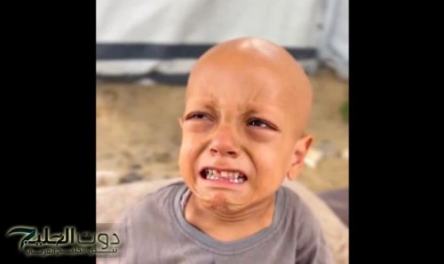 أنا جعان .. صرخة عبدالله الأخيرة .. فيديو