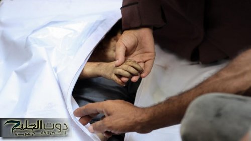 الصحة في غزة: 6 حالات وفاة نتيجة المجاعة