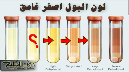 أوعى تتجاهلها.. ظهور هذه العلامة في البول يعني أنك مصاب بمرض خطير