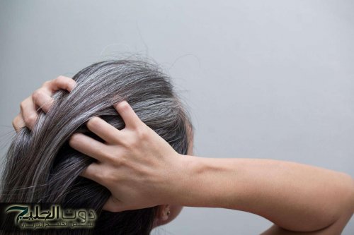 «انتهى زمن الحناء والصبغات».. إليك مكون واحد يخلصك من الشعر الأبيض في خلال أيام!!