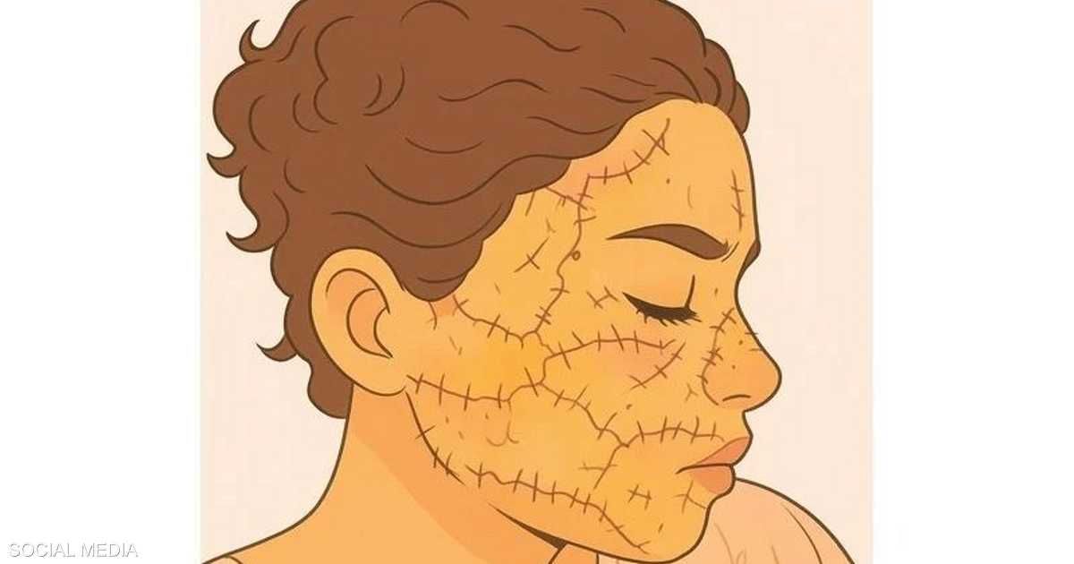 العالم اليوم - جريمة تهزّ المغرب.. رجل يشوّه وجه امرأة بسلاح أبيض