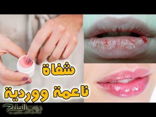 ودعي التشققات.. أفضل وصفات طبيعية لعلاج جفاف الشفاه في الشتاء