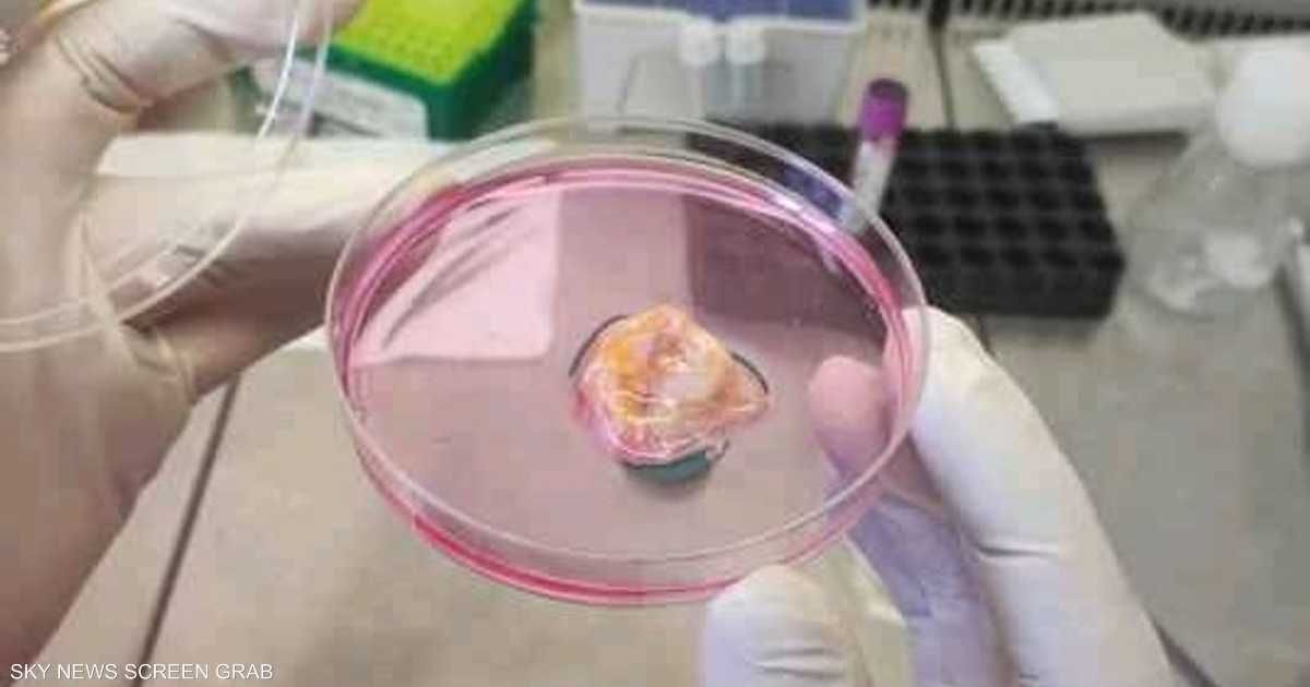 العالم اليوم - مركز أبوظبي للخلايا الجذعية يطلق علاجا مبتكرا للسرطان