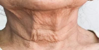 أخبار اليمن : صورة مُرعبة.. ما تفعله التكنولوجيا بالرقبة