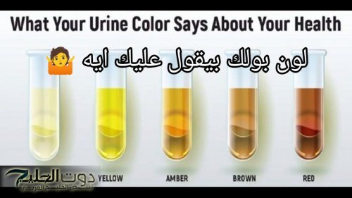 «مؤشر لمرض خطير».. أحذر من هذه ظهور العلامة على لون البول | أوعى تتجاهلها
