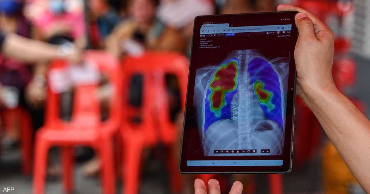 العالم اليوم - الصحة العالمية: وفاة أكثر من مليون شخص بهذا المرض