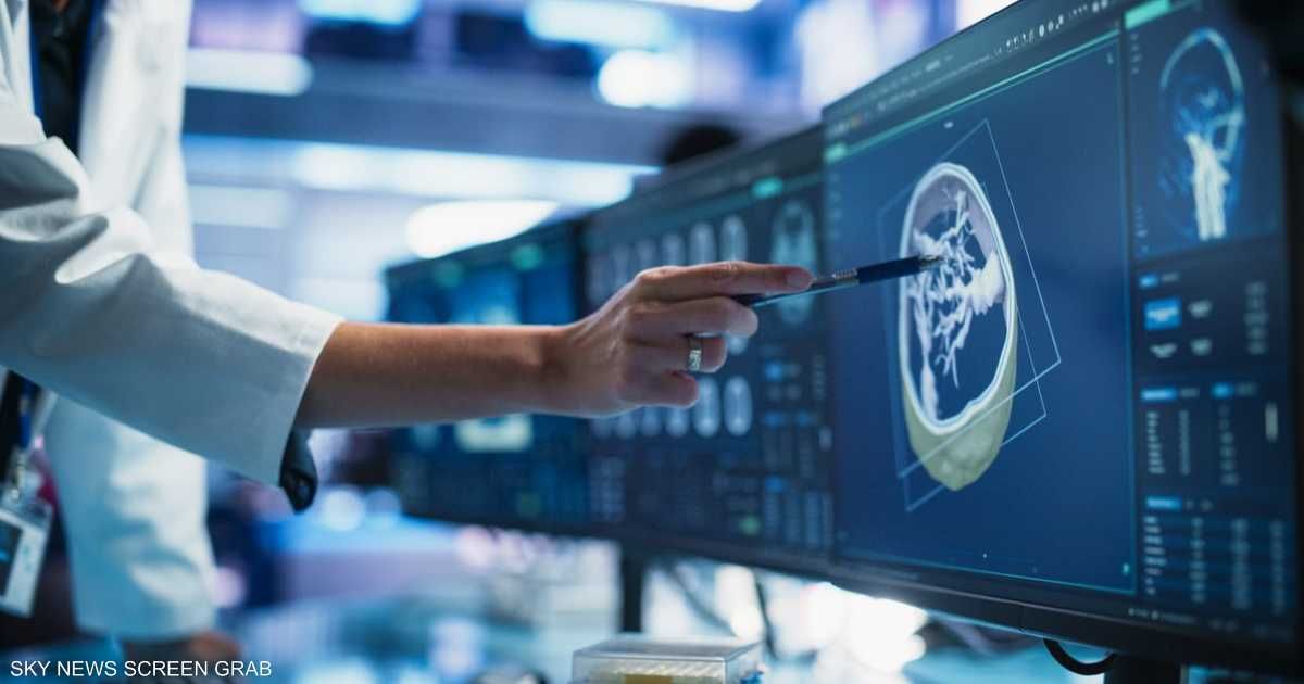 العالم اليوم - أداة ذكاء اصطناعي تتفوق على الجراحين في زراعة الأعضاء