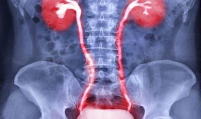 أخبار اليمن : فاكهة تُخفف حرقان البول بسرعة.. تعرف عليها