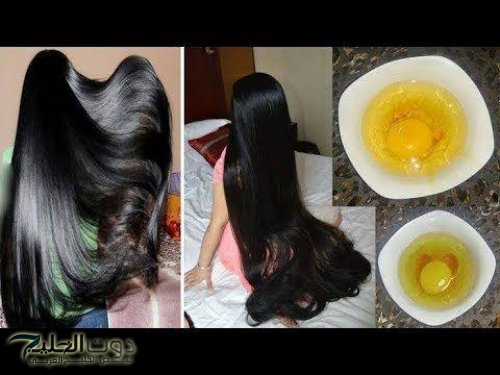 «وداعا لزراعة الشعر».. اقـوى كريم طبيعي لإطالة الشعر وانبات الفراغات بدون استخدام أي مواد ضارة