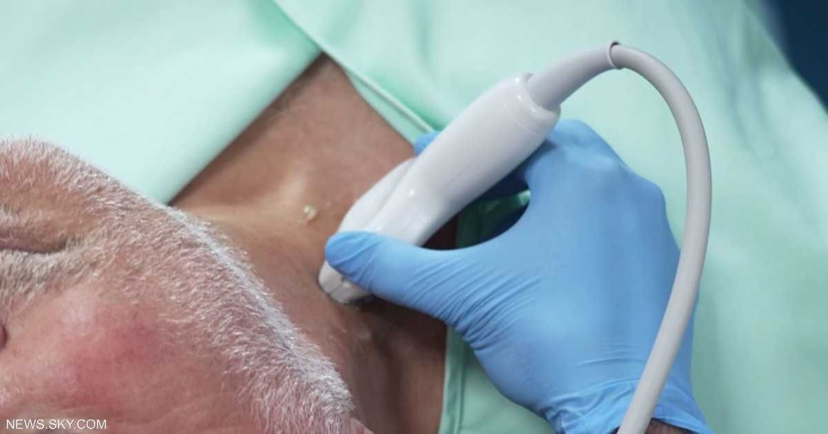 العالم اليوم - فحص بسيط يكشف خطر الإصابة بالنوبات القلبية والسكتات الدماغية