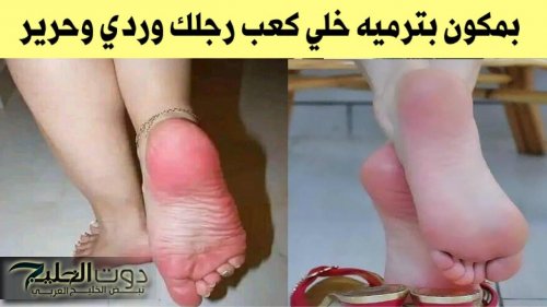 «عرفتها من صحبتي المغربيه».. كعب رجلك هيبقي قشطة خلطة الخل الرهيبة لتقشير القدمين وإزالة الجلد الميت والقشور