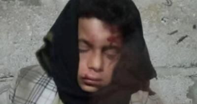 أخبار اليمن : بالأسماء.. ضبط 7 متهمين بالاعتداء على طفل دمت