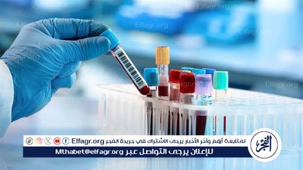 تحليل فيروسات B وC وHIV لمتعاطي المخدرات بالحقن ضمن خدمات علاج الإدمان المجانية في السويس