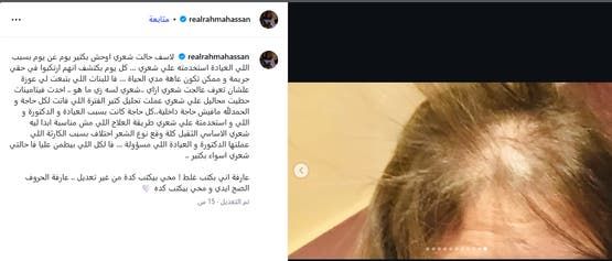 رحمة حسن تكشف عن خطأ طبي يهددها بعاهة دائمة ويبعدها عن الأضواء (صورة)