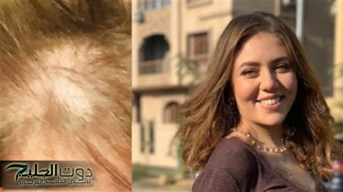 تحذير للسيدات.. رحمة حسن تخرج عن صمتها وتكشف كيف فقدت شعرها بسبب مواد التجميل؟