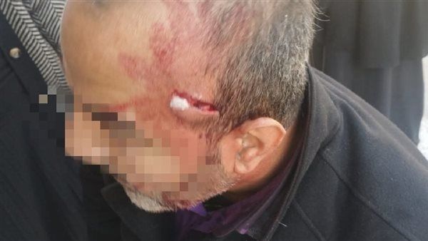 شخص يدعى أنه والد طالبة يعتدى على معلم بآلة حادة فى الإسماعيلية