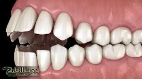 أسباب ألم الفك تعرف عليها