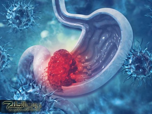 "وصفة من شيخ العطارين".. وصفة أعشاب طبيعية للقضاء على جرثومة المعدة على عهدة شيخ العطارين