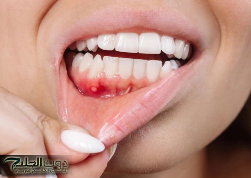 تلاحظها عند تنظيف أسنانك.. احذر أعراض خطيرة لـ السرطان