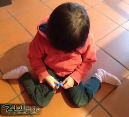 استشارى جراحة عظام يحذر من وضعية الجلوس على شكل W للأطفال