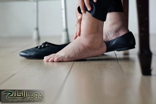 الصحة البريطانية تحذر من ظهور أعراض قصور القلب فى الساقين