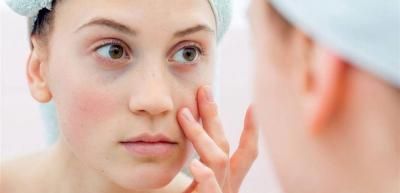 علامة في عينيك قد تنذر بنوبة قلبية