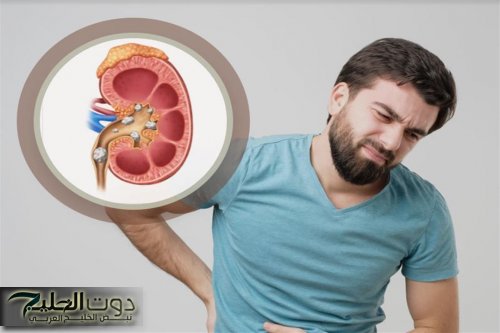 وداعًا للألم .. نصائح ذهبية للوقاية من حصوات الكلى في الشتاء