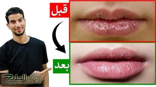 افركي شفايفك بشوية سكر وزيت زيتون وشوفي النعومة هتبسطك أوي من أول دقيقتين