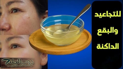 ماسك سهل من مطبخك ومش هتتخيلي وشك هيبقى ناعم وصافي إزاي بعده