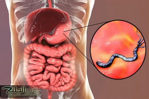 "كوب واحد هينضف معدتك" اعشاب لعلاج جرثومة المعدة نهائيا بدون مضادات حيوية.. تخلص منها بلا رجعة