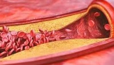 أخبار اليمن : 8 خرافات شائعة عن الكوليسترول