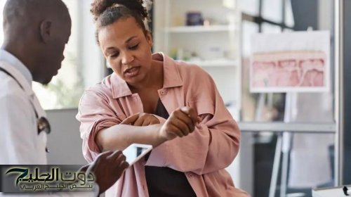 علاج جديد مبتكر بالضوء للصدفية بلا آثار جانبية