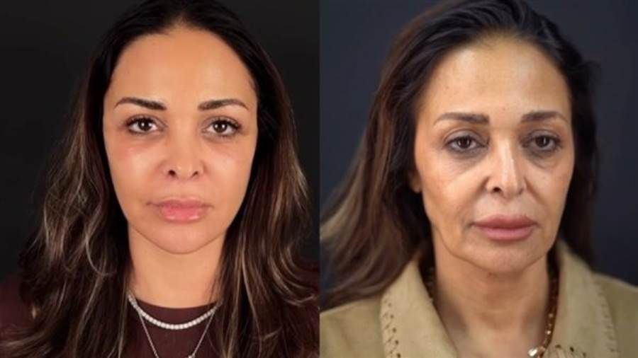 داليا البحيري تخضع لعملية تجميل في الوجه أثارت الفنانة داليا البحيري جدلا واسعا خلال الساعات القليلة الماضية بعد الإعلان عن خضوعها لعملية شد الوجه إقرأ المزيد