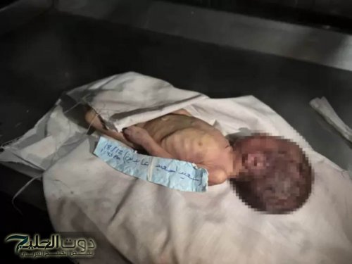 غزة تحت القصف والبرد .. الأطفال أول الضحايا