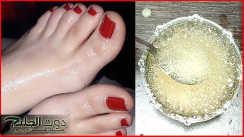 كعب رجلك هيبقي قشطة.. خلطة الخل الرهيبة لتقشير القدمين وإزالة الجلد الميت والقشور في دقائق