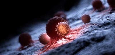 عامل خفي يؤثر على تطور السرطان