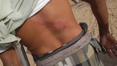 أخبار اليمن : المرتزقة يعتدون على صيادين في سواحل ميدي