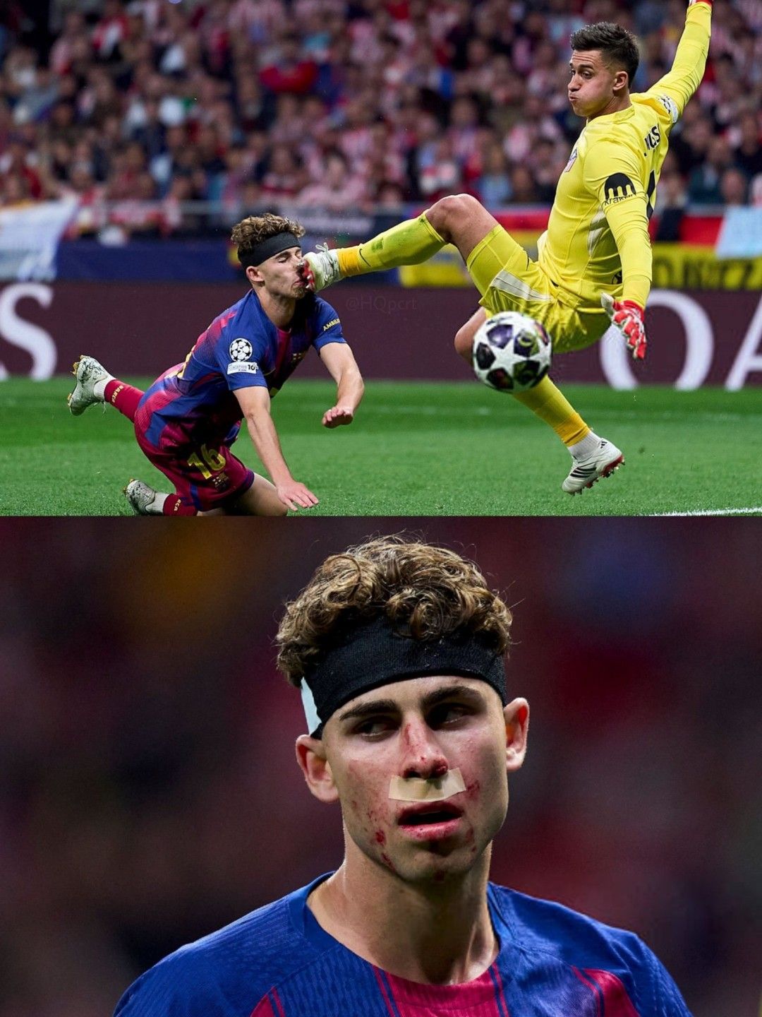 اطّلع على.. إصابة دامية لنجم برشلونة ضد أتلتيكو مدريد...