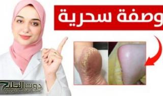 «سر جمال كعب الهوانم ».. طريقة سحرية للقضاء على التشققات في الكعبين وازالة الجلد الميت في ثواني فقط ومن أول مره .. مستحيل تخطر على بال العفريت نفسه!!