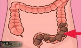 "حل رباني".. عشبة في كل مطبخ تنظف القولون بسرعة وتخلصك من البراز المتحجر - وداعًا لزيارات الطبيب!