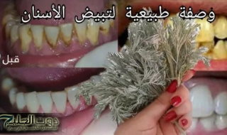 أهم عشبة للجميع .. أعشاب تعالج اصفرار الأسنان ورائحة الفم الكريهة.. تعرف عليها الآن وامتلك ابتسامة رائعة