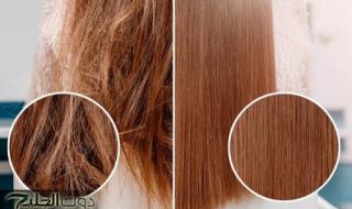 شعرك هيبقا كتلة جمال في الشتاء.. اكتشفي أقوى 5 ماسكات طبيعية هترجّعله النعومة من أول مرة
