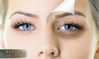 نصائح لهالات تحت العين
