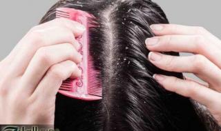 جربيها مرة وهتدعيلي من قلبك!! ..وصفة الأعشاب السحرية لتنعيم الشعر ومنع القشرة في وقت قياسي.. هتشوفي النتيجة