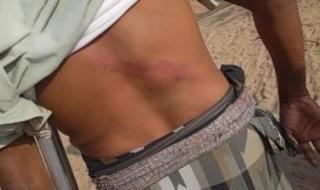 أخبار اليمن : المرتزقة يعتدون على صيادين في سواحل ميدي