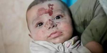 أخبار اليمن : تصفية وجودية للأجيال.. إسرائيل أعدمت 20 ألف طفل فلسطيني