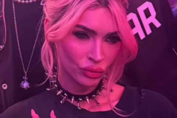 ميغان فوكس بملامح صادمة بسبب عمليات التجميل