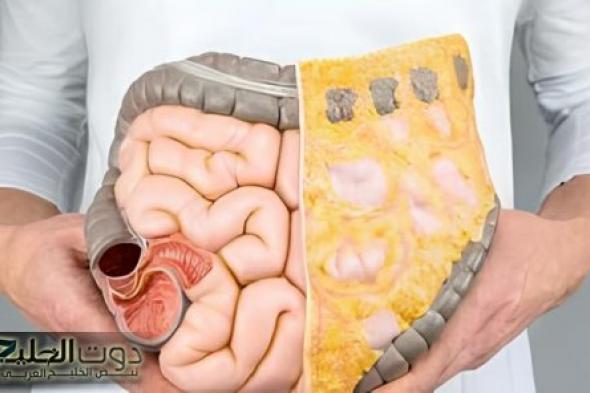 العشبة الخارقة لتنظيف القولون .. أفضل عشبة سحرية برخص التراب هتنضف القولون تماما وهتخلصك من البراز المتحجر في ثواني.. مش هتحتاج تروح لدكتور تاني