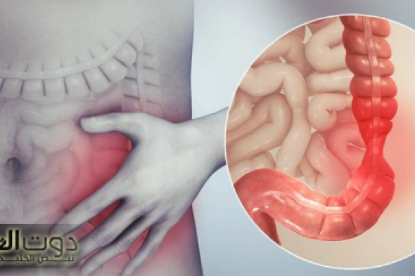 عشبة السنا الحل السحري لتنظيف القولون وتعزيز صحة الجهاز الهضمي!!..5 فوائد فعالة لعلاج القولون عند استخدام عشبة السنا..صحتك هتتغير كليا!!